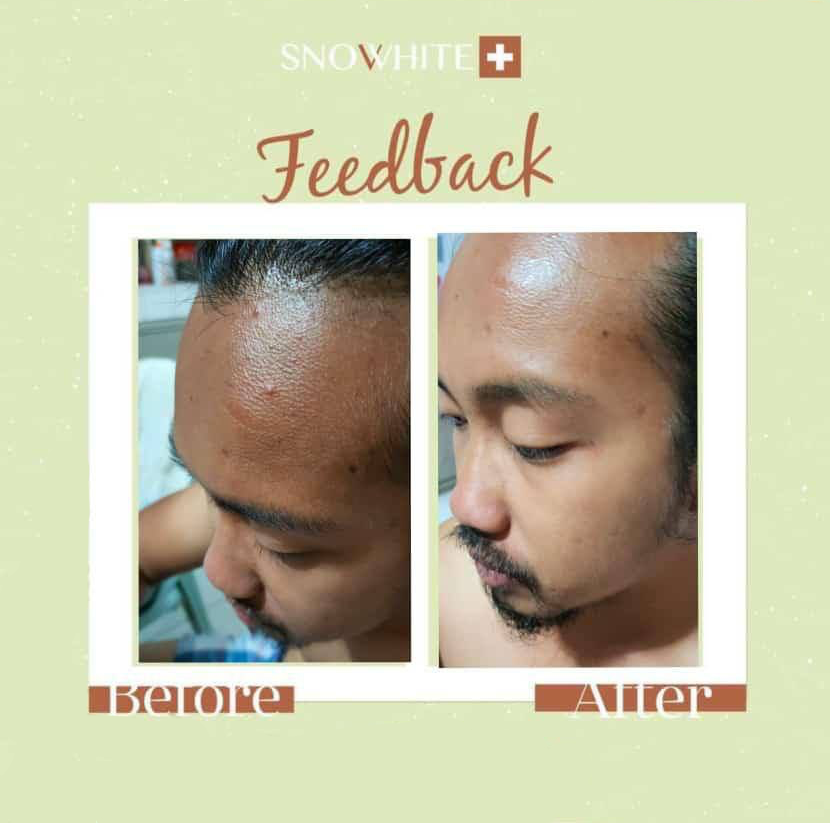 snovvhite testimoni snovvhite review snovvhite supplement kkm snovvhite supplement testimoni snovvhite whitening booster