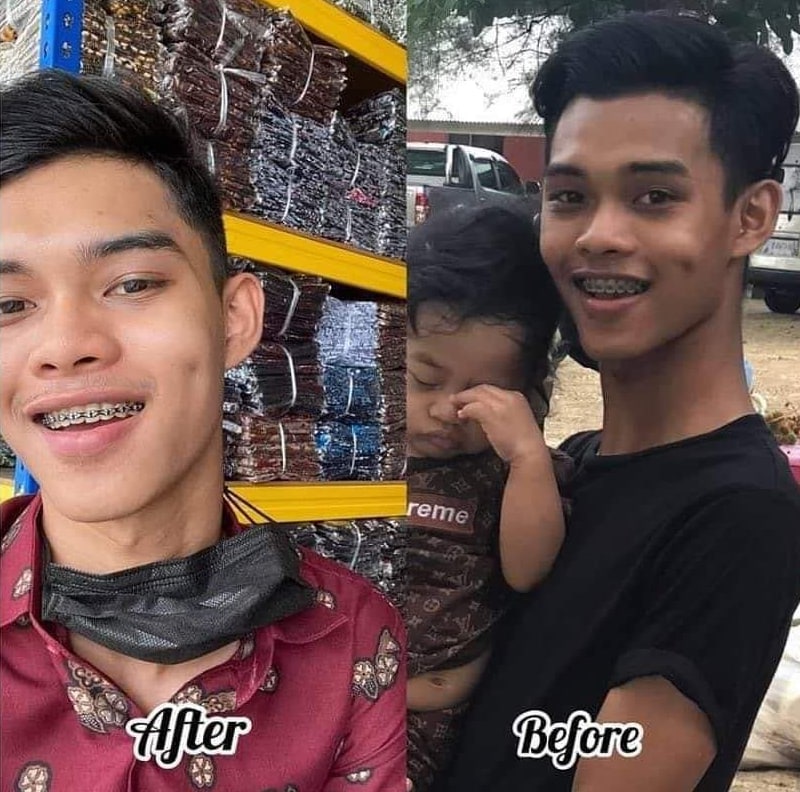 snovvhite testimoni snovvhite review snovvhite supplement kkm snovvhite supplement testimoni snovvhite whitening booster