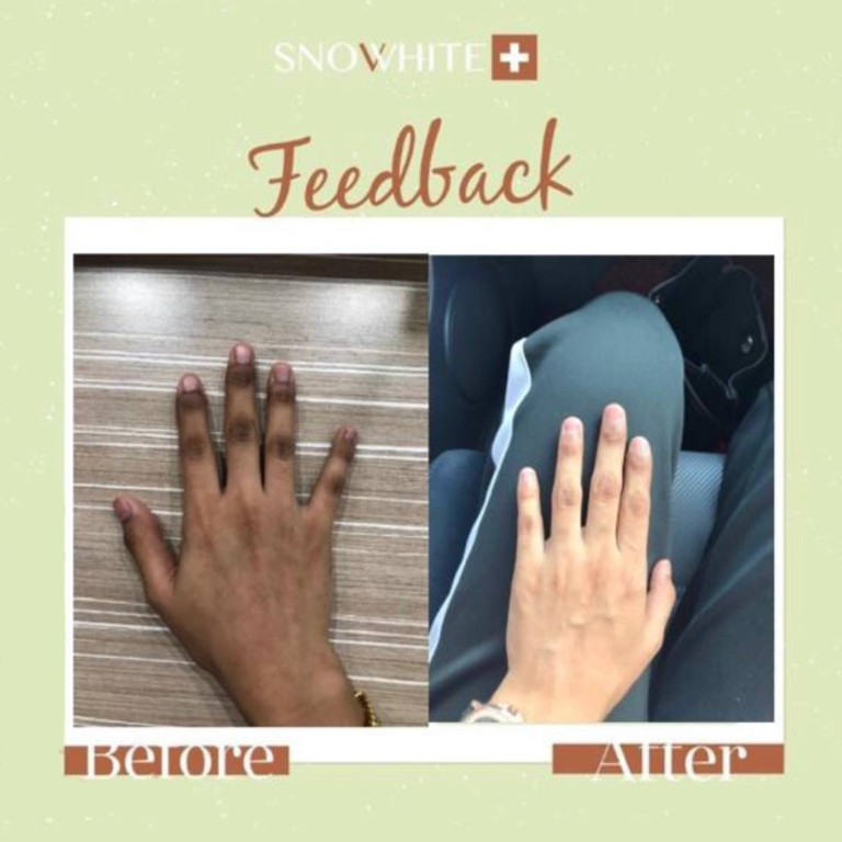 snovvhite testimoni snovvhite review snovvhite supplement kkm snovvhite supplement testimoni snovvhite whitening booster