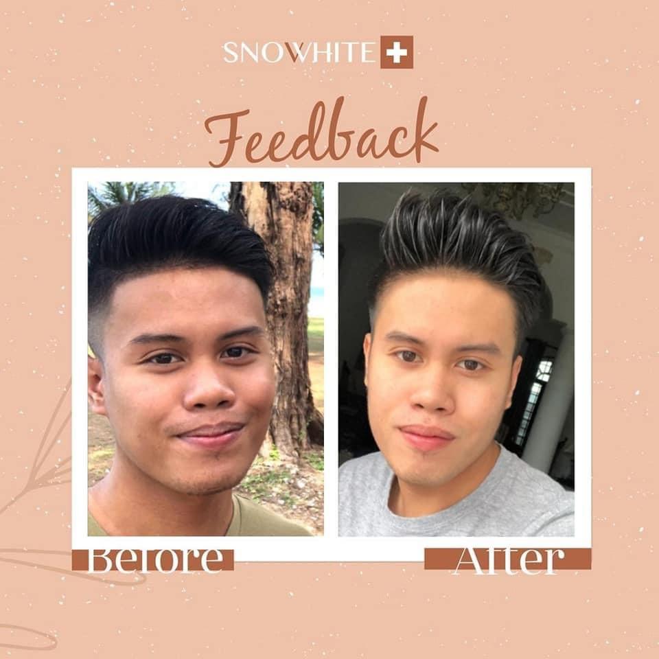 snovvhite testimoni snovvhite review snovvhite supplement kkm snovvhite supplement testimoni snovvhite whitening booster