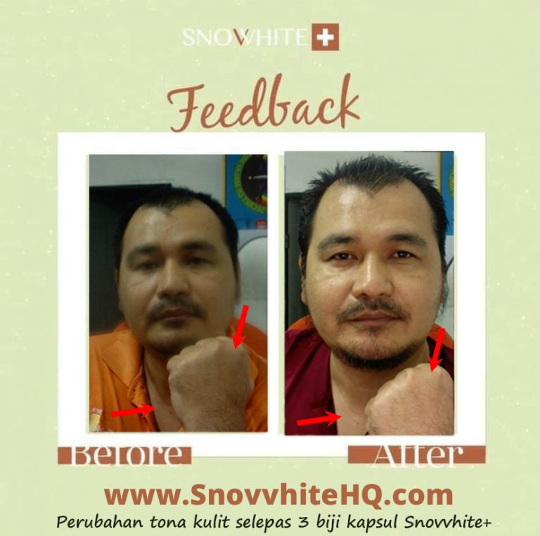 snovvhite testimoni snovvhite review snovvhite supplement kkm snovvhite supplement testimoni snovvhite whitening booster