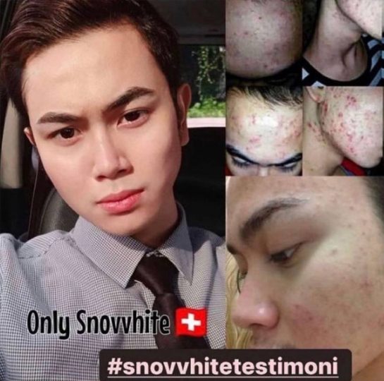 snovvhite testimoni snovvhite review snovvhite supplement kkm snovvhite supplement testimoni snovvhite whitening booster